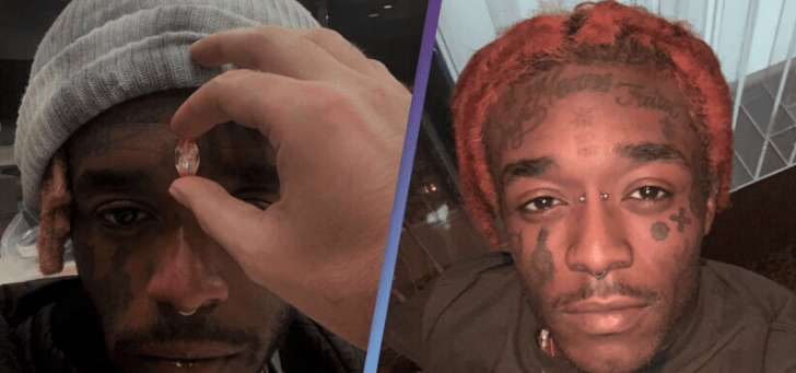 [WATCH] Video Surfaces Of Lil Uzi Vert’s $24M Pink Diamond Dermal Piercing
