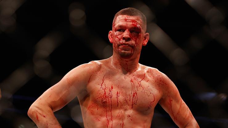 Nate Diaz Praised After Bloody Grudge Match Against Leon Edwards